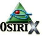 New OsiriX 'lite' version coming soon